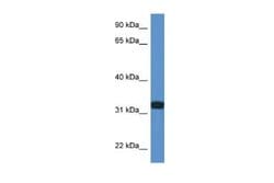 DDO Rabbit anti-Human, Polyclonal, Novus Biologicals:Antibodies:Primary